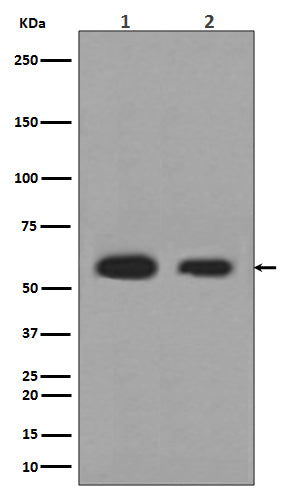 Anti-Calreticulin Rabbit Polyclonal Antibody