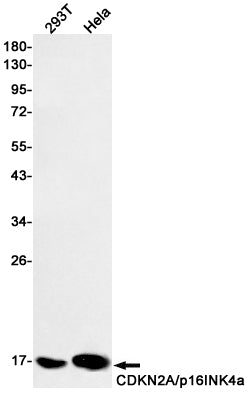 Anti-CDKN2A/p16INK4a Rabbit Polyclonal Antibody