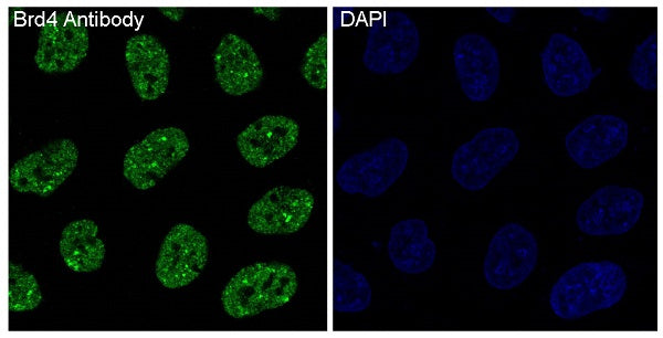 Anti-BRD4 Rabbit Polyclonal Antibody