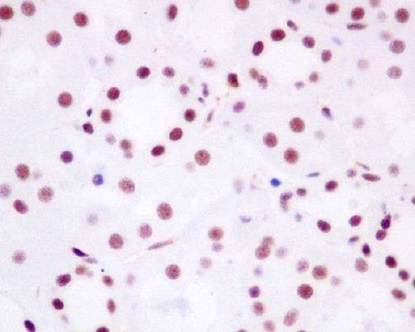 Anti-BRD4 Rabbit Polyclonal Antibody