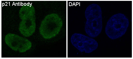 Anti-p21 Rabbit Polyclonal Antibody