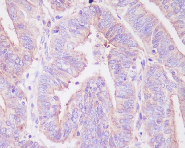 Anti-Phospho-FOXO3A (Ser235) Rabbit Polyclonal Antibody