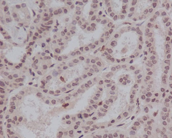 Anti-Phospho-STAT5a (Tyr694) Rabbit Polyclonal Antibody