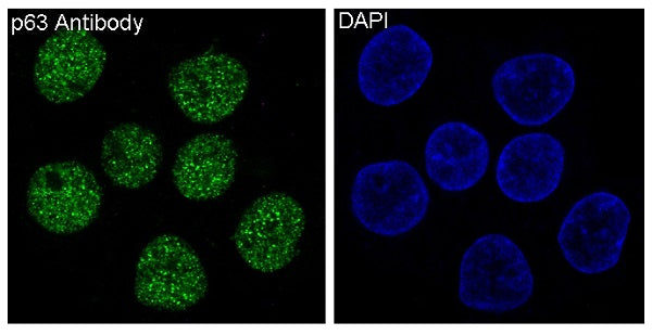 Anti-p63 Rabbit Polyclonal Antibody