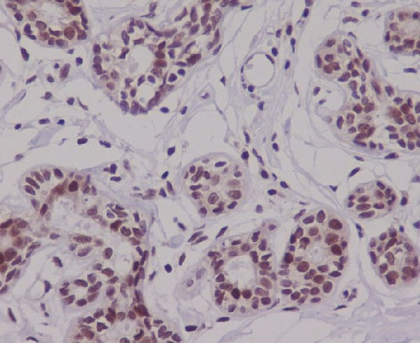 Anti-p63 Rabbit Polyclonal Antibody
