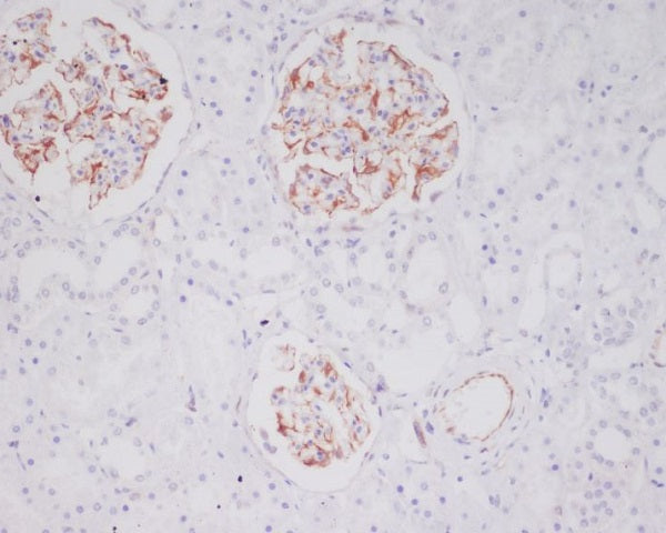 Anti-Mast Cell Tryptase Rabbit Polyclonal Antibody