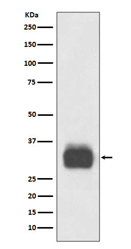Anti-Mast Cell Tryptase Rabbit Polyclonal Antibody