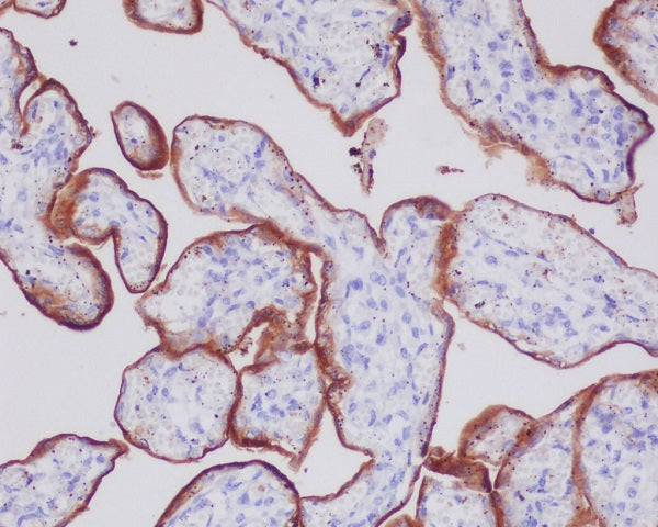 Anti-Transferrin Receptor 1 Rabbit Polyclonal Antibody