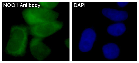 Anti-NQO1 Rabbit Polyclonal Antibody