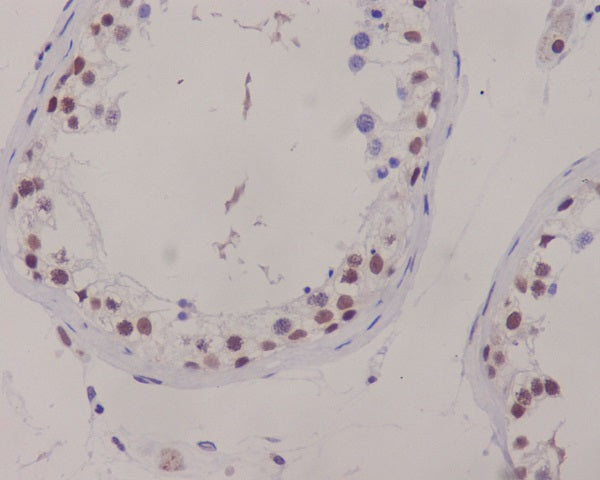 Anti-XRCC1 Rabbit Polyclonal Antibody