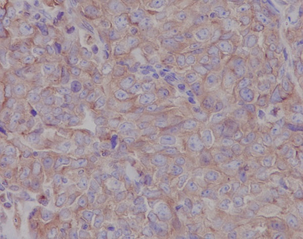 Anti-LOX Rabbit Polyclonal Antibody