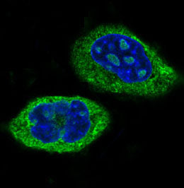 Anti-KAT13D Rabbit Polyclonal Antibody