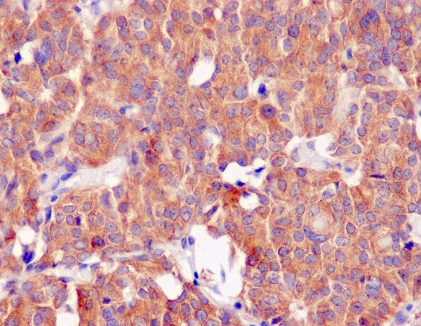 Anti-KAT13D Rabbit Polyclonal Antibody