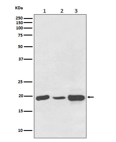 Anti-NDUFB8 Rabbit Polyclonal Antibody
