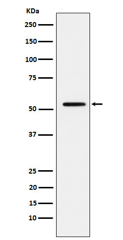 Anti-MMP1 Rabbit Polyclonal Antibody