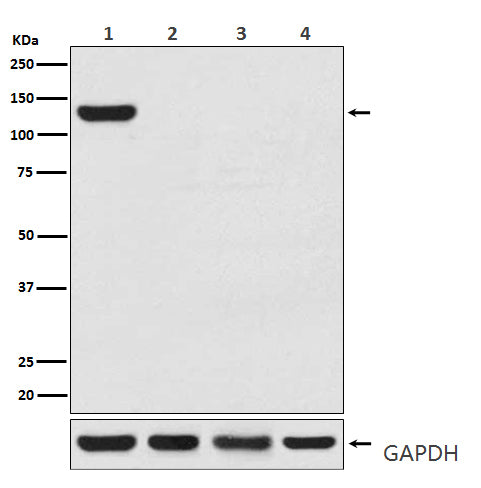 Anti-CRISPR Cas9 SA Rabbit Polyclonal Antibody