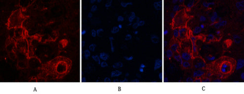 Anti-Carcino Embryonic Antigen CEA (2A8) Mouse Monoclonal Antibody