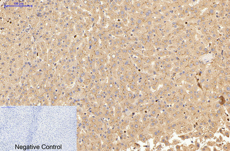 Anti-Carcino Embryonic Antigen CEA (2A8) Mouse Monoclonal Antibody