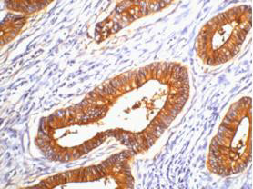 Anti-Carcino Embryonic Antigen CEA (2A8) Mouse Monoclonal Antibody