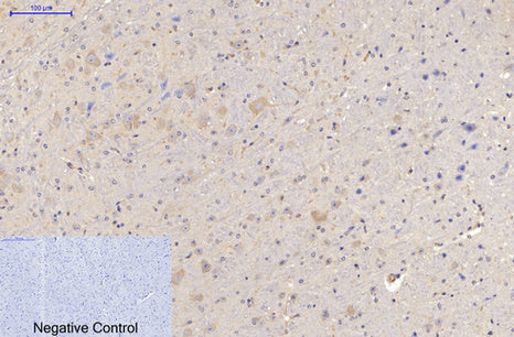 Anti-MAP2 (3B5) Mouse Monoclonal Antibody