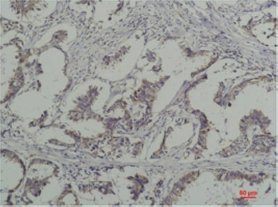 Anti-Phospho-Tyrosine (6G6) Mouse Monoclonal Antibody
