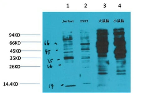 Anti-Phospho-Tyrosine (6G6) Mouse Monoclonal Antibody
