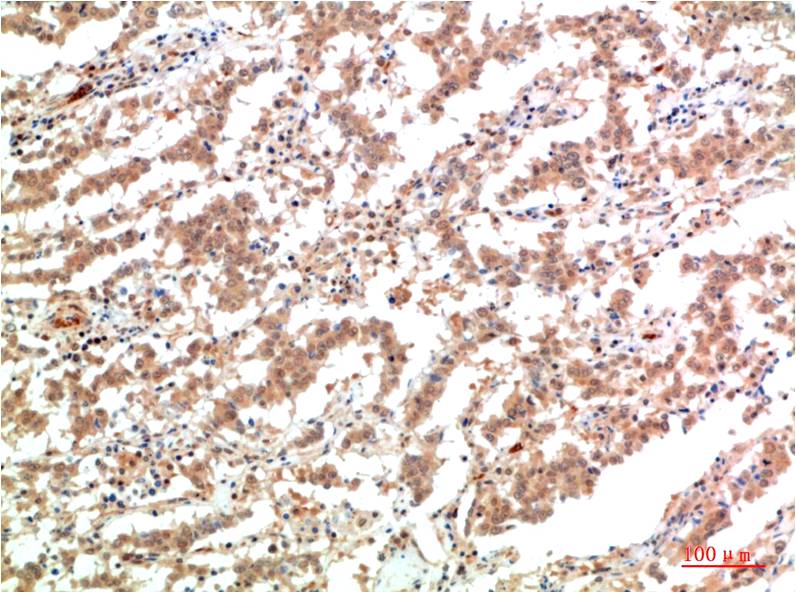 Anti-JAK2 (7H5) Mouse Monoclonal Antibody