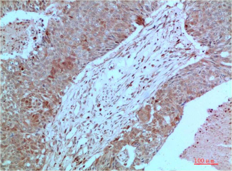 Anti-JAK2 (7H5) Mouse Monoclonal Antibody