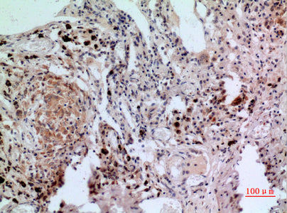 Anti-NFAT2 Rabbit Polyclonal Antibody