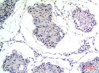 Anti-Thrombospondin 2 Rabbit Polyclonal Antibody