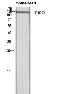 Anti-Thrombospondin 2 Rabbit Polyclonal Antibody
