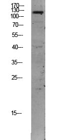 Anti-TIE2 Rabbit Polyclonal Antibody