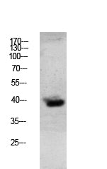 Anti-Granzyme B Rabbit Polyclonal Antibody