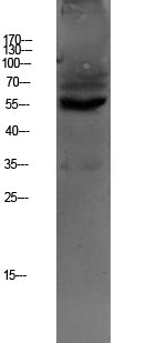 Anti-OAT1 Rabbit Polyclonal Antibody