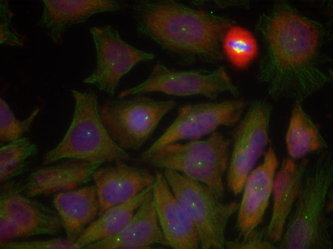 Anti-Phospho-PTEN (Ser380/Thr382/383) Rabbit Polyclonal Antibody