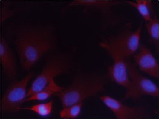 Anti-Phospho-PTEN (Ser380/Thr382/383) Rabbit Polyclonal Antibody