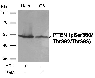 Anti-Phospho-PTEN (Ser380/Thr382/383) Rabbit Polyclonal Antibody