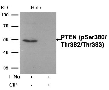Anti-Phospho-PTEN (Ser380/Thr382/383) Rabbit Polyclonal Antibody