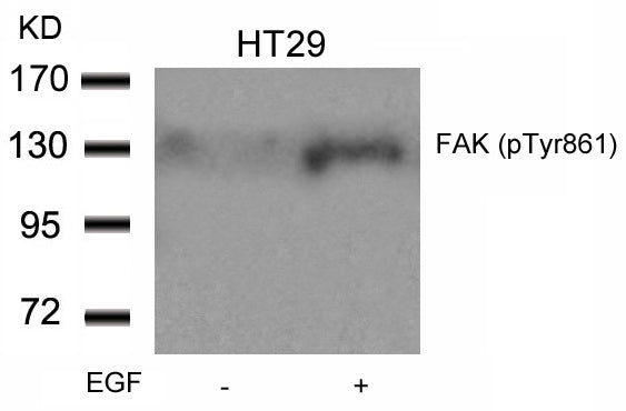 Anti-Phospho-FAK (Tyr861) Rabbit Polyclonal Antibody