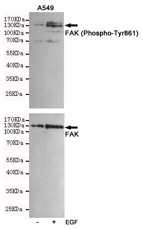 Anti-Phospho-FAK (Tyr861) Rabbit Polyclonal Antibody