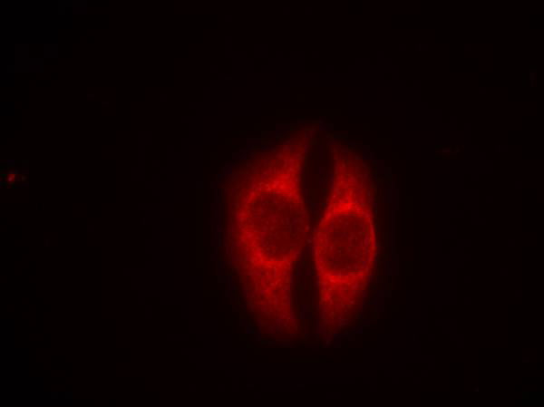 Anti-Phospho-p53 (Ser37) Rabbit Polyclonal Antibody