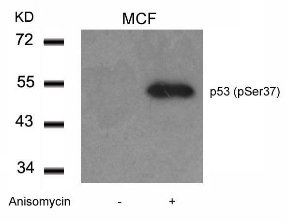 Anti-Phospho-p53 (Ser37) Rabbit Polyclonal Antibody