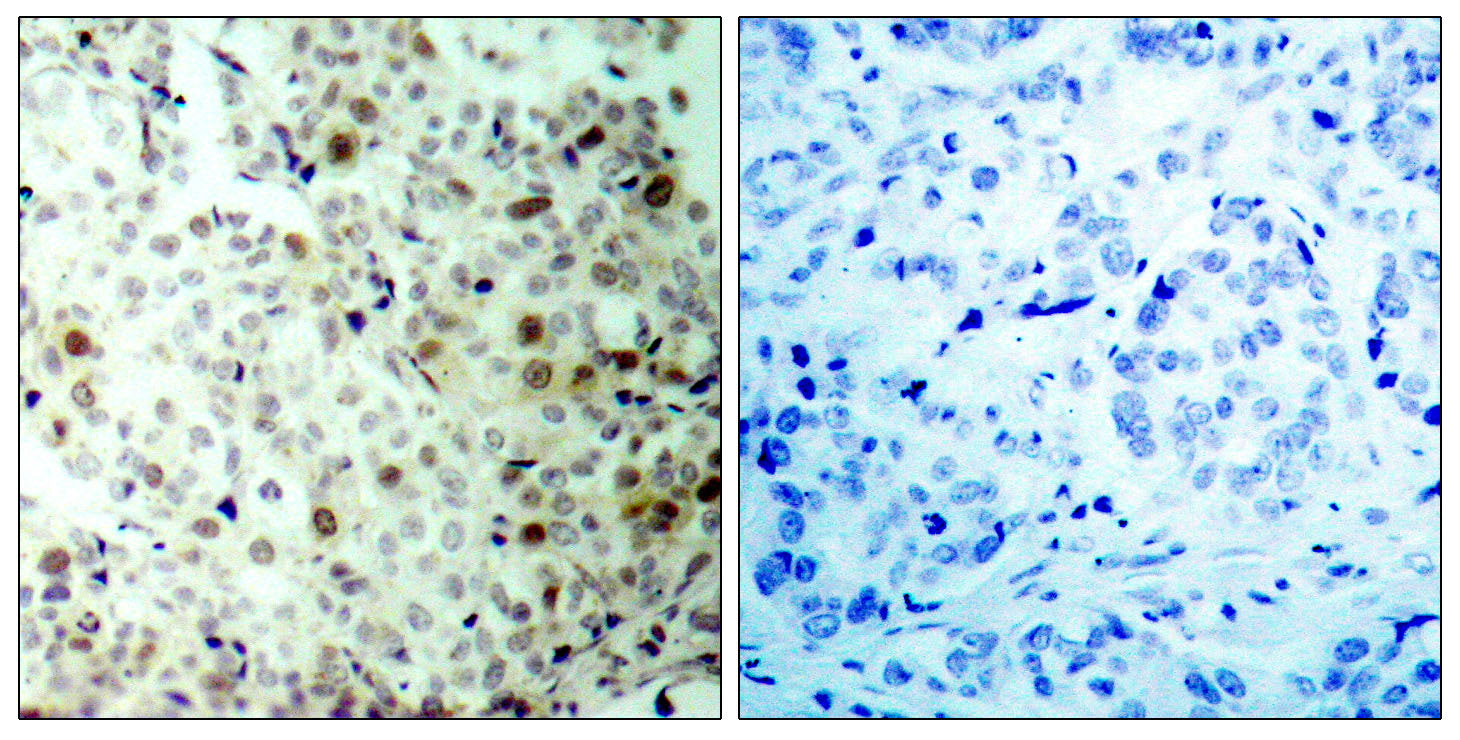 Anti-Phospho-CDK2 (Thr160) Rabbit Polyclonal Antibody
