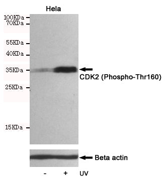 Anti-Phospho-CDK2 (Thr160) Rabbit Polyclonal Antibody