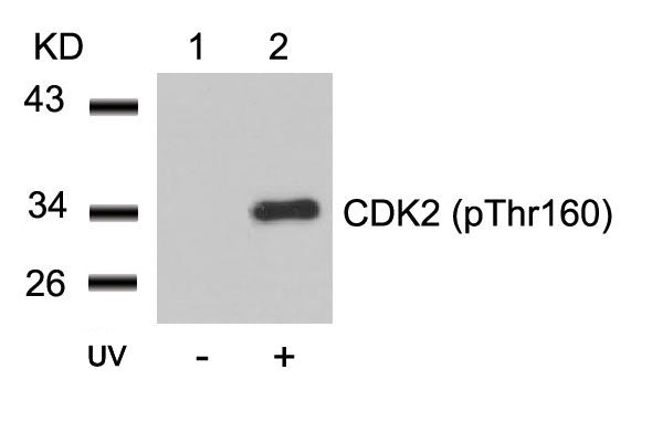 Anti-Phospho-CDK2 (Thr160) Rabbit Polyclonal Antibody
