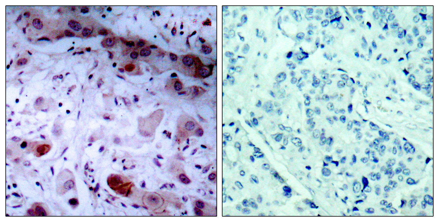 Anti-Phospho-JAK1 (Tyr1022) Rabbit Polyclonal Antibody
