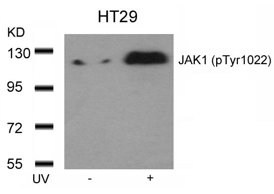 Anti-Phospho-JAK1 (Tyr1022) Rabbit Polyclonal Antibody