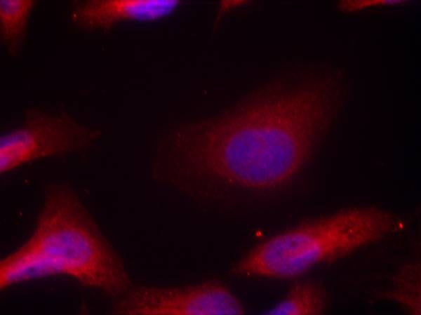 Anti-Phospho-Src (Tyr530) Rabbit Polyclonal Antibody