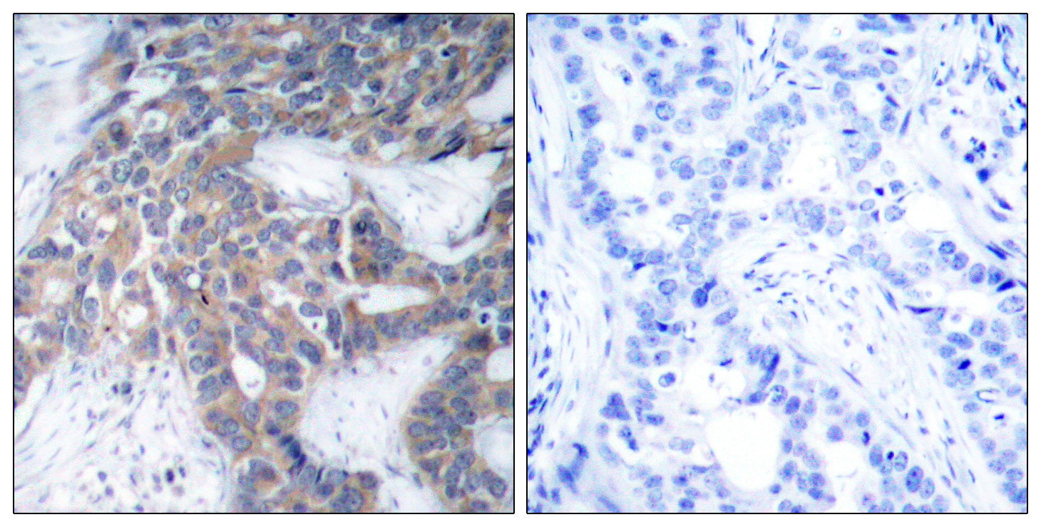 Anti-Phospho-MEK1/2 (Ser217/221) Rabbit Polyclonal Antibody