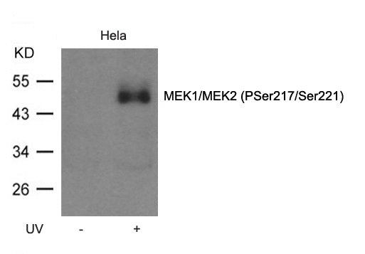 Anti-Phospho-MEK1/2 (Ser217/221) Rabbit Polyclonal Antibody